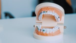 best dental implants