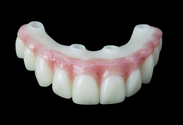all on 4 teeth made from acrylic-PMMA materials