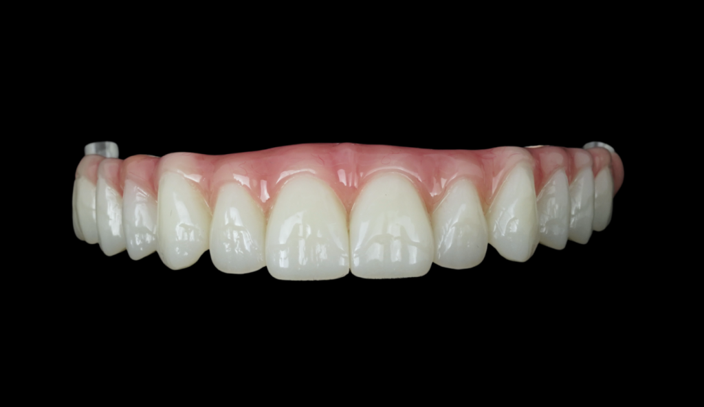 all on 4 prosthesis teeth made from hybrid materials