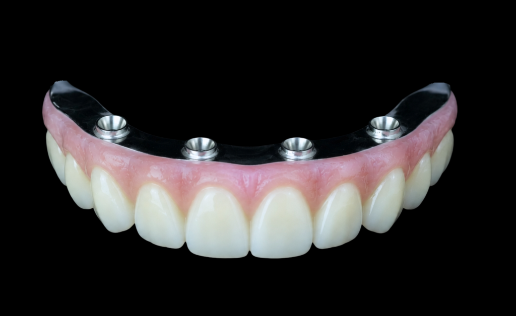 all on 4 prosthesis teeth made from zirconia materials