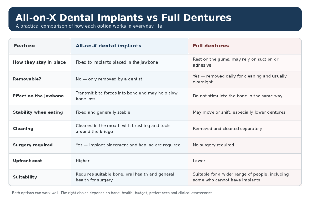 a comparison table for all on 4 vs dentures